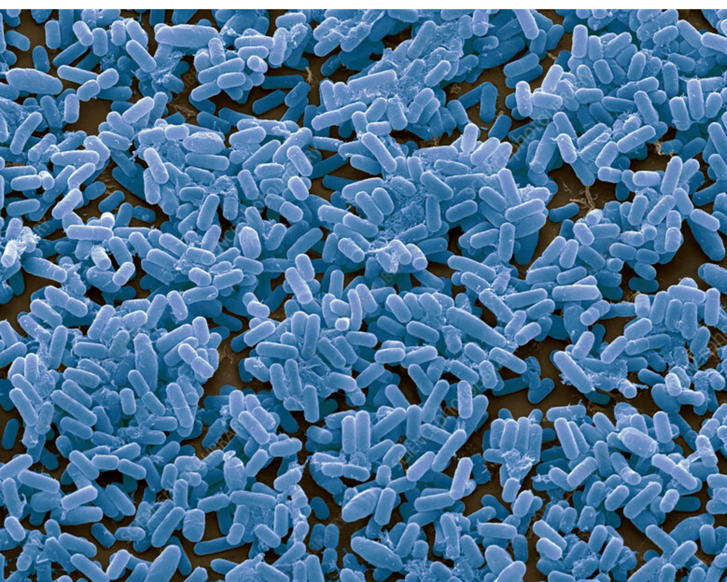 Сенная палочка. Bacillus subtilis (Сенная палочка). Бациллюс субтилис Bacillus subtilis. Bacillus subtilis штамма 534. Сенная палочка b.subtilis.