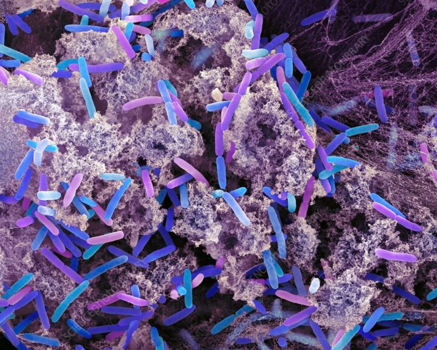 Микроорганизмы. Бактерия Pseudomonas aeruginosa. Pseudomonas aeruginosa биопленка. Псевдомонас аэругиноза микроскопия. Pseudomonas aeruginosa микроскоп.